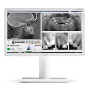 Nio Color 2MP - MDNC-2123