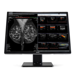 Nio Fusion 12MP (MDNC-12130)
