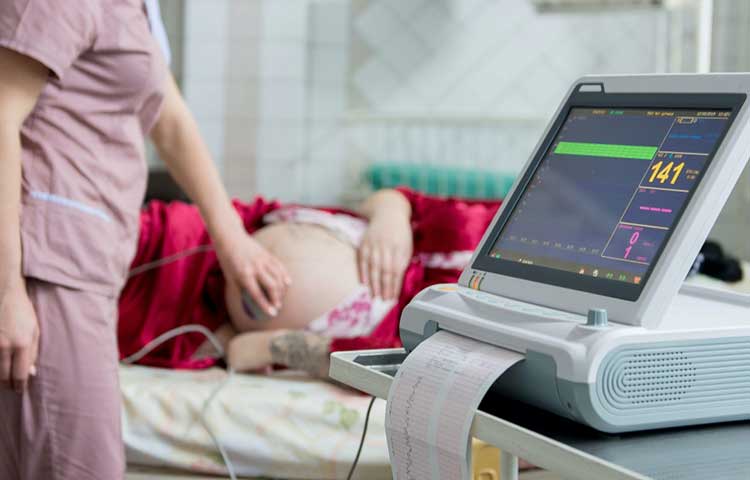 Monitor Fetale